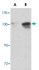 PAB13051 - NUP155