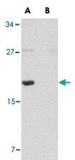 PAB13054 - MED28