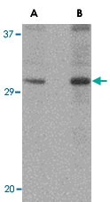 PAB13055 - DNAL1