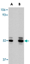 PAB13056 - Acid ceramidase