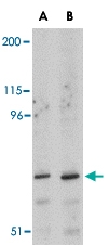 PAB13057 - Neutral ceramidase / ASAH2