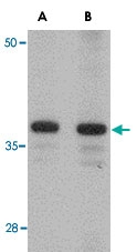 PAB13058 - CDCA8 / Borealin