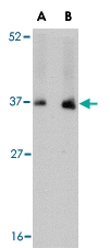 PAB13059 - Neudesin
