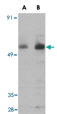 PAB13061 - PARL