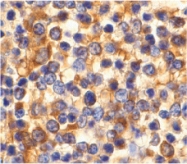 PAB13064 - CD193 / CCR3