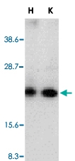 PAB13066 - RAIDD