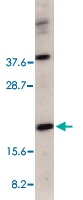 PAB13067 - RAIDD
