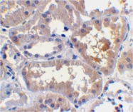 PAB13067 - RAIDD