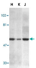 PAB13070 - CD261 / TRAILR1