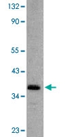 PAB13073 - DFFB / CAD