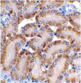 PAB13073 - DFFB / CAD