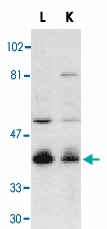 PAB13074 - DFFB / CAD
