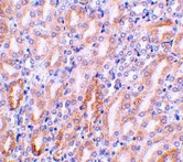 PAB13074 - DFFB / CAD