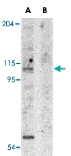 PAB13075 - APAF1