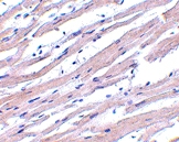 PAB13075 - APAF1