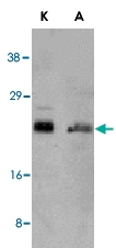 PAB13076 - Bcl-2-like 11