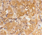 PAB13076 - Bcl-2-like 11