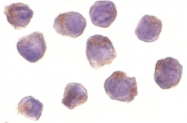 PAB13078 - RIPK2