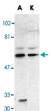PAB13078 - RIPK2