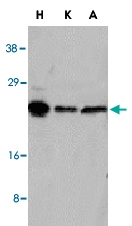 PAB13079 - NOL3 / ARC