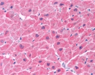 PAB13079 - NOL3 / ARC