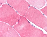 PAB13079 - NOL3 / ARC