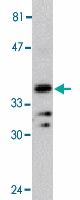 PAB13080 - MYD88