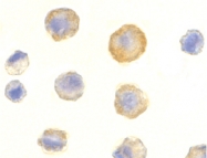 PAB13081 - CD263 / TRAILR3