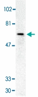 PAB13081 - CD263 / TRAILR3