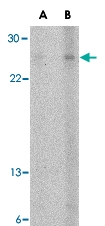 PAB13084 - CD256 / APRIL