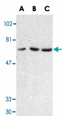 PAB13085 - CD263 / TRAILR3