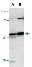 PAB13086 - Caspase-12