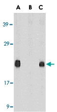 PAB13090 - DIABLO / SMAC