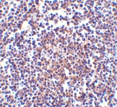 PAB13091 - AVEN