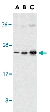 PAB13092 - CD256 / APRIL