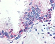 PAB13092 - CD256 / APRIL