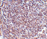PAB13093 - AVEN