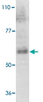 PAB13094 - Interleukin-21 receptor / IL21R