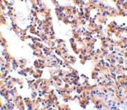 PAB13094 - Interleukin-21 receptor / IL21R