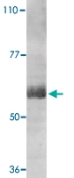 PAB13095 - Interleukin-21 receptor / IL21R