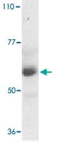 PAB13100 - Adapter protein CIKS
