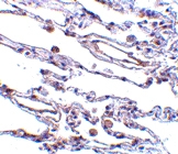 PAB13100 - Adapter protein CIKS