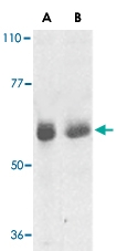 PAB13101 - Adapter protein CIKS