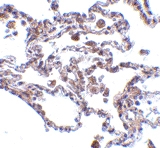 PAB13101 - Adapter protein CIKS