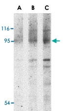 PAB13102 - CARD15 / NOD2