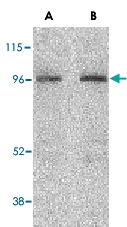 PAB13103 - CARD15 / NOD2