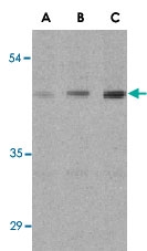 PAB13109 - Anthrax toxin receptor 1 / ANTXR1