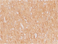 PAB13109 - Anthrax toxin receptor 1 / ANTXR1