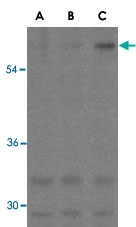PAB13110 - Anthrax toxin receptor 1 / ANTXR1