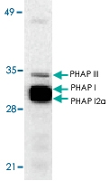 PAB13111 - ANP32A